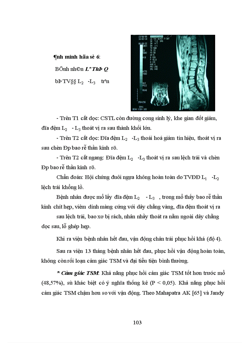 image for page Nghiên cứu chẩn đoán và điều trị phẫu thuật thoát vị đĩa đệm vùng thắt lưng - cùng gây hội chứng đuôi ngựa