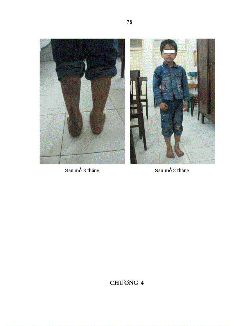 image for page Đánh giá kết quả điều trị khuyết hổng phần mềm vùng gót, cổ chân bằng vạt da-cân hiển ngoài cuống ngoại vi tại bệnh viện Việt Đức