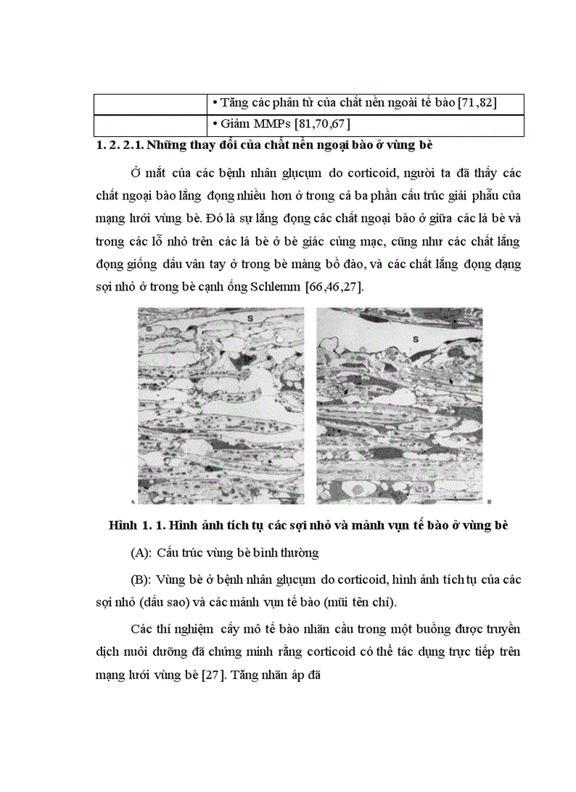image for page Nghiên cứu đặc điểm lâm sàng và kết quả điều trị phẫu thuật glôcôm ở trẻ em dùng corticoid kéo dài tại bệnh viện mắt Trung Ương
