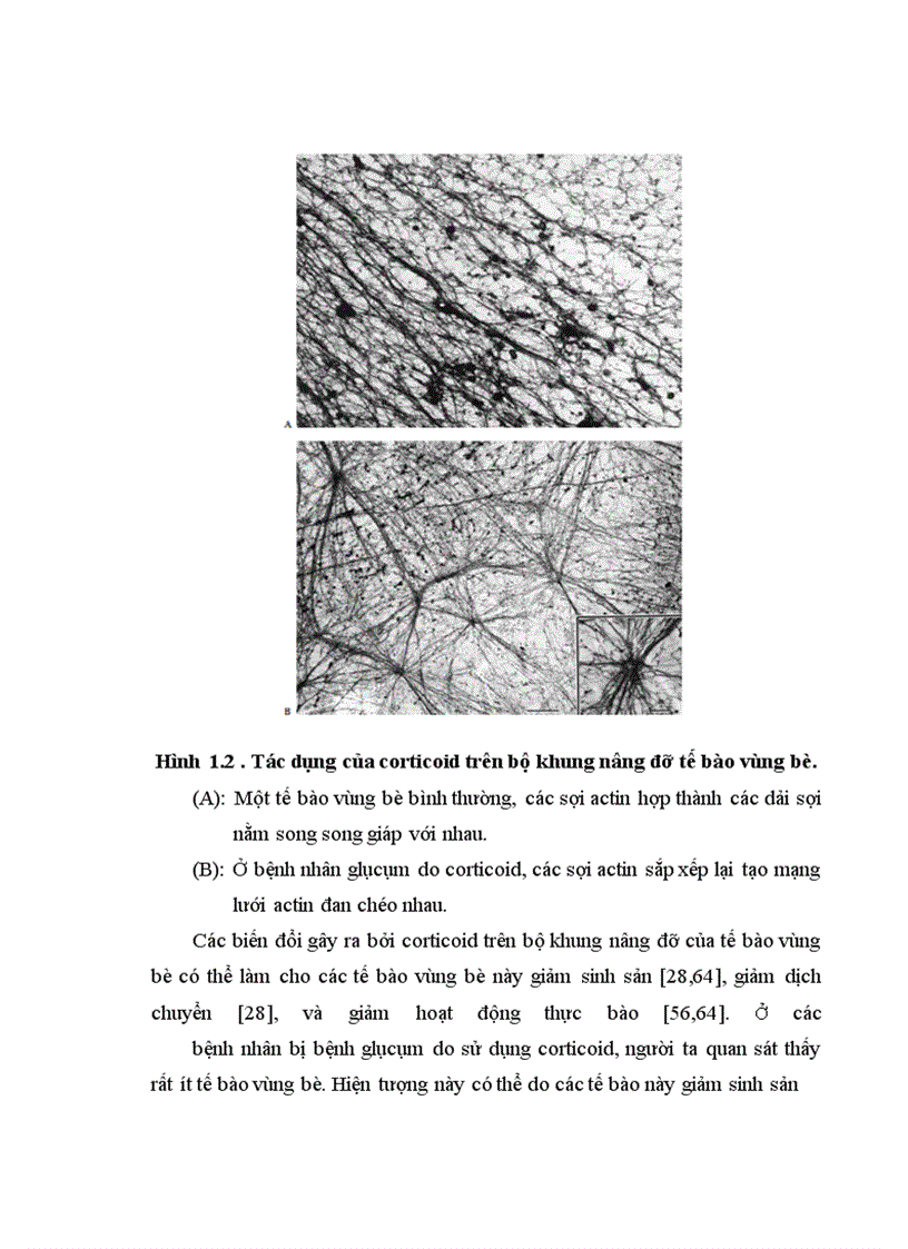 image for page Nghiên cứu đặc điểm lâm sàng và kết quả điều trị phẫu thuật glôcôm ở trẻ em dùng corticoid kéo dài tại bệnh viện mắt Trung Ương