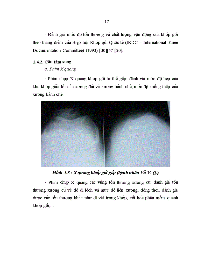 image for page Đánh giá kết quả phẫu thuật nội soi điều trị hạn chế vận động khớp gối sau chấn thương