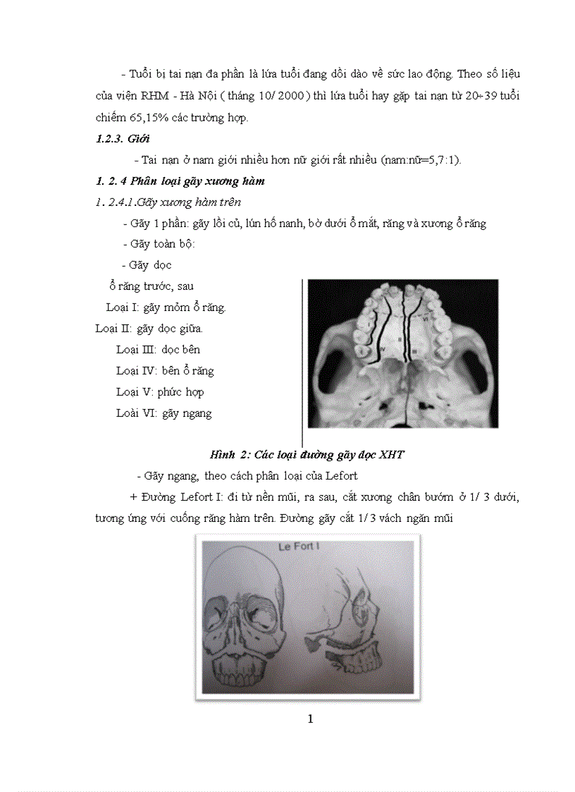 image for page Nhận xét tình trạng vệ sinh răng miệng và đánh giá hiệu quả can thiệp vệ sinh răng miệng cho bệnh nhân gãy xương hàm hở trước phẫu thuật