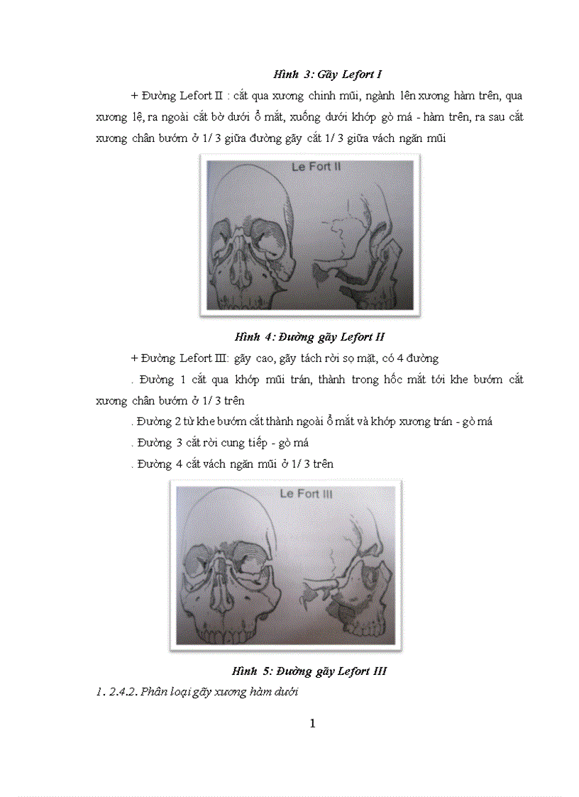 image for page Nhận xét tình trạng vệ sinh răng miệng và đánh giá hiệu quả can thiệp vệ sinh răng miệng cho bệnh nhân gãy xương hàm hở trước phẫu thuật