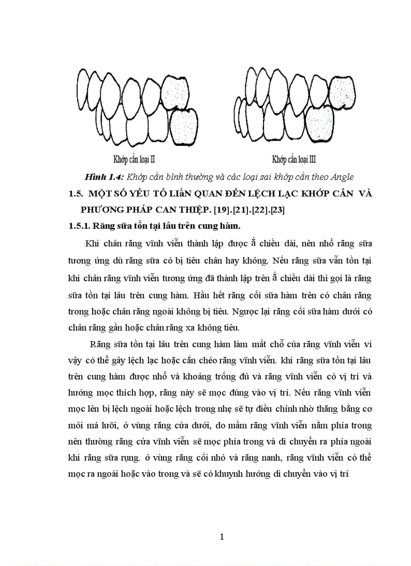 image for page Nhận xét thực trạng khớp cắn và một số yếu tố liên quan tới lệch lạc khớp cắn của trẻ 9 - 12 tuổi tại thành phố Hòa Bình.