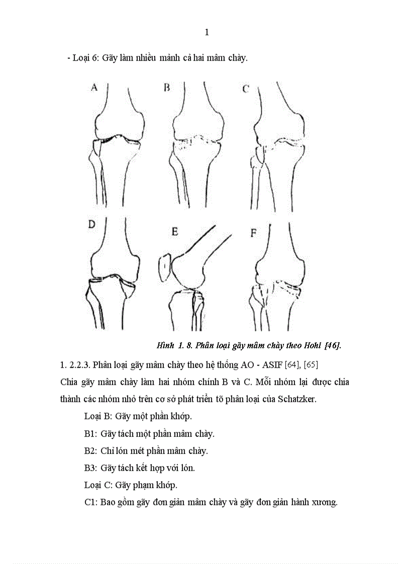 image for page Đánh giá các tổn thương và kết quả điều trị gãy mâm chày do chấn thương tại Bệnh viện 103