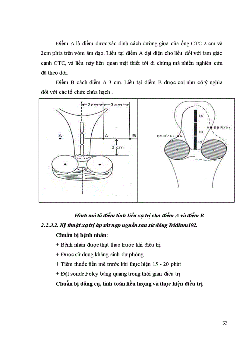 image for page Điều trị ung thư cổ tử cung giai đoạn IB đến IIA có xạ trị tiền phầu bằng Iridium 192 tại Bệnh viện K.
