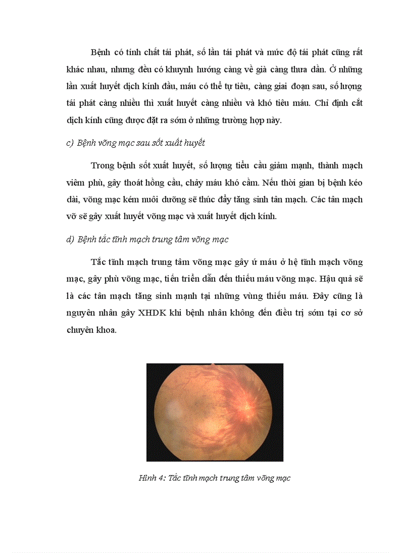 image for page Phẫu thuật cắt dịch kính điều trị xuất huyết dịch kính nội sinh