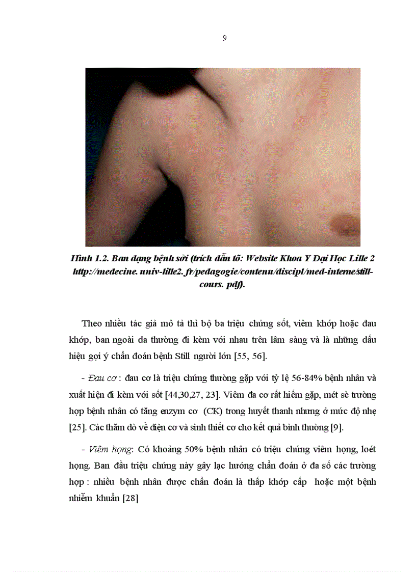 image for page Nghiên cứu áp dụng các tiêu chuẩn chẩn đoán bệnh Still người lớn