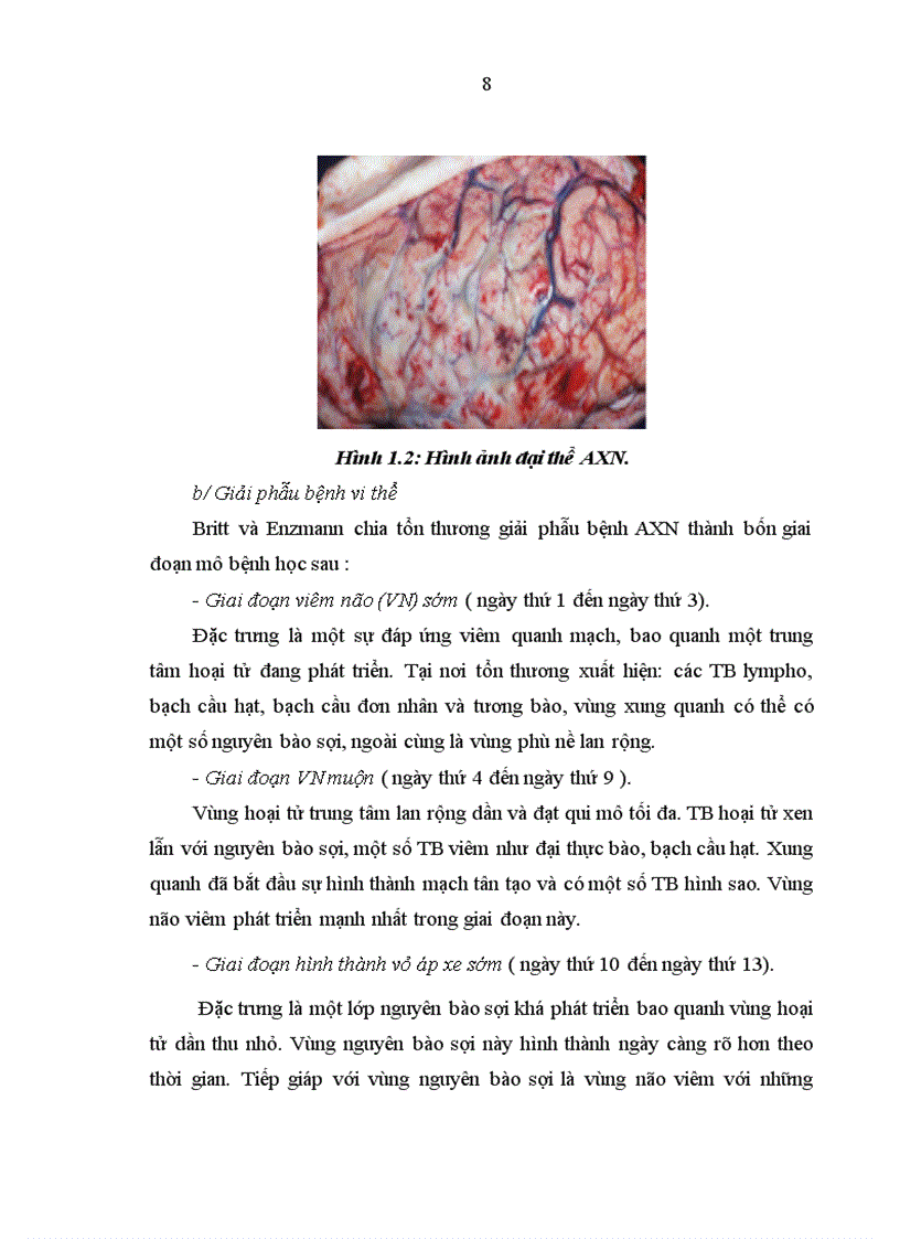 image for page Nhận xét về kết quả điều trị áp xe não tại Bệnh viện Nhi Trung Ương từ năm 2004 - 2009.