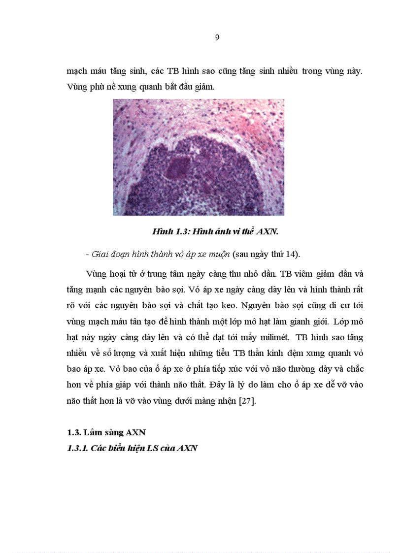 image for page Nhận xét về kết quả điều trị áp xe não tại Bệnh viện Nhi Trung Ương từ năm 2004 - 2009.