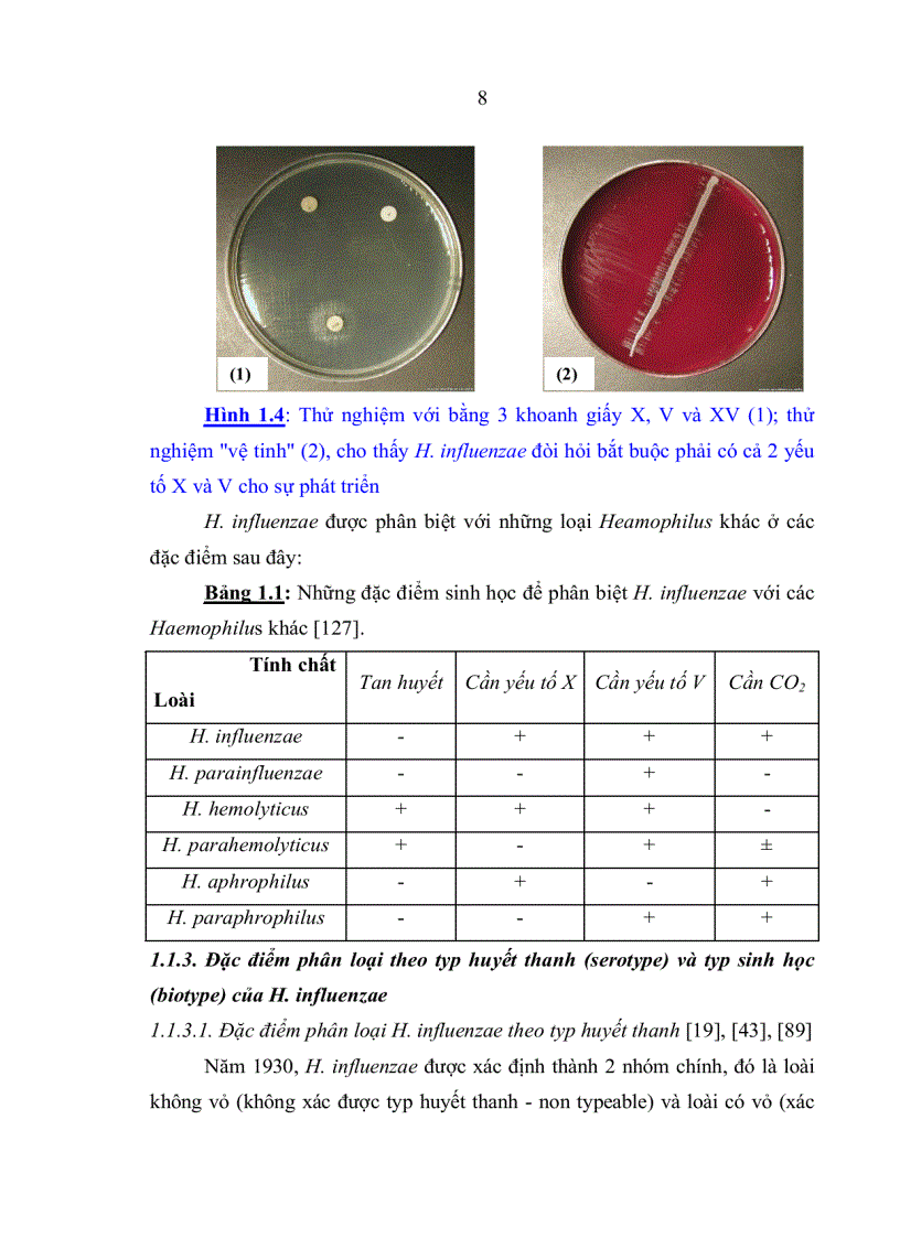 image for page Đặc điểm sinh học phân tử của Haemophilus influenzae typ b phân lập từ bệnh nhi viêm màng não dưới 5 tuổi và trẻ khỏe mạnh tại nhà trẻ mẫu giáo