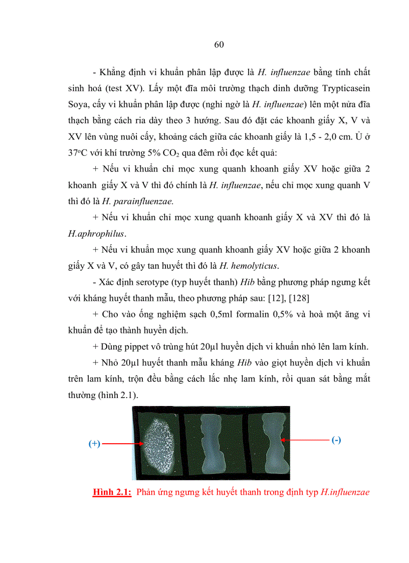 image for page Đặc điểm sinh học phân tử của Haemophilus influenzae typ b phân lập từ bệnh nhi viêm màng não dưới 5 tuổi và trẻ khỏe mạnh tại nhà trẻ mẫu giáo