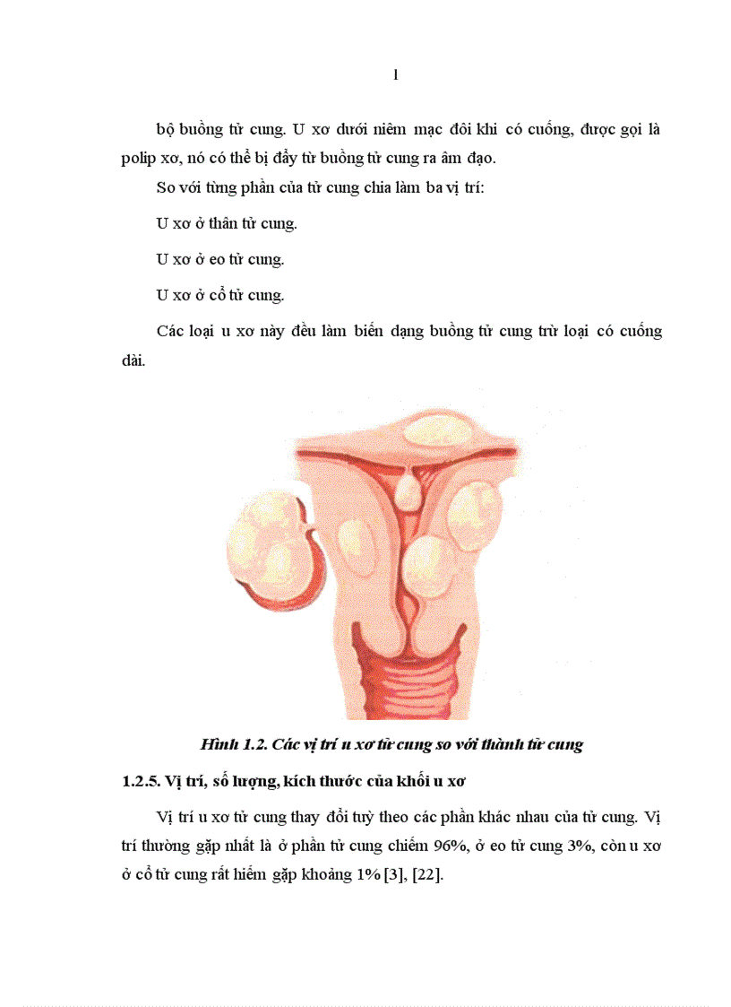 image for page Tình hình bóc u xơ tử cung qua nội soi tại bệnh viện Phụ sản Trung ương từ tháng 1 năm 2005 đến tháng 6 năm 2009