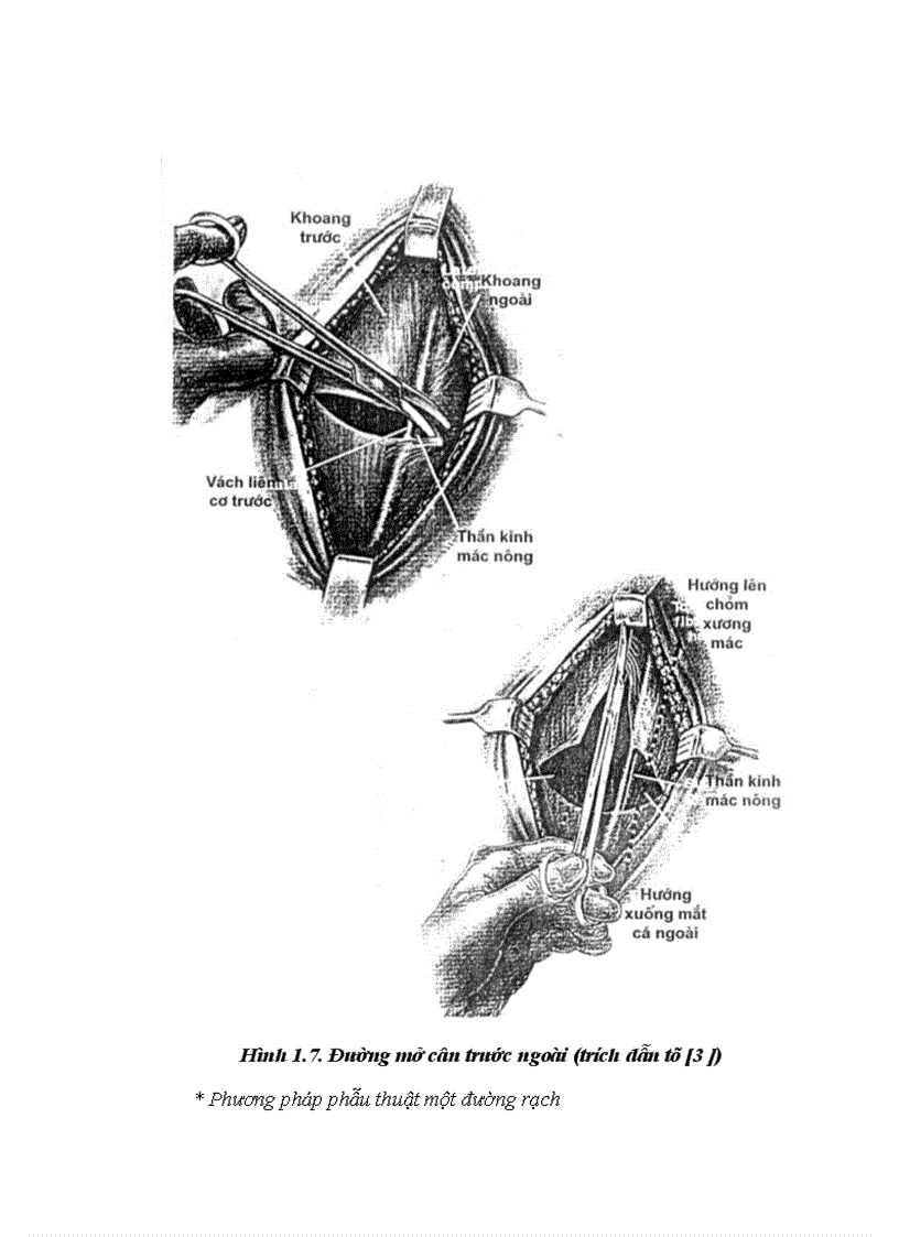 image for page Đánh giá kết quả điều trị hội chứng chèn ép khoang cẳng chân sau chấn thương tại bệnh viện việt đức từ 2003 2007