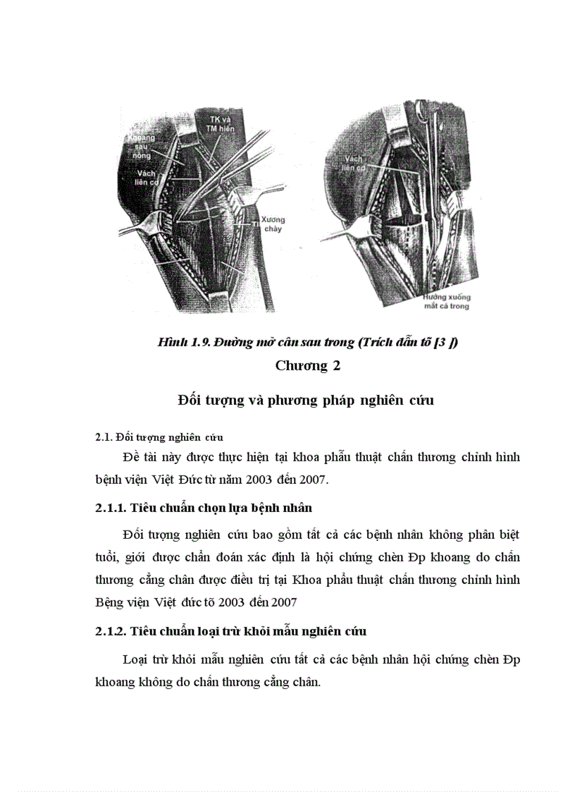 image for page Đánh giá kết quả điều trị hội chứng chèn ép khoang cẳng chân sau chấn thương tại bệnh viện việt đức từ 2003 2007