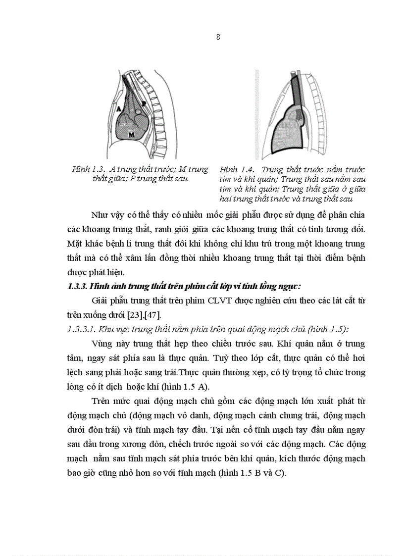 image for page Mô tả đặc điểm hình ảnh và giá trị chẩn đoán của cắt lớp vi tính đối với U quái trung thất