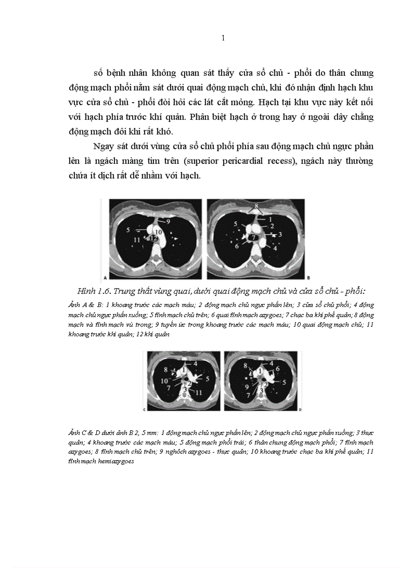 image for page Mô tả đặc điểm hình ảnh và giá trị chẩn đoán của cắt lớp vi tính đối với U quái trung thất