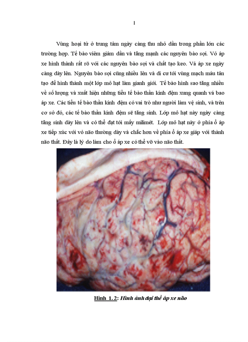 image for page Đặc điểm lâm sàng cận lâm sàng áp xe n o ở trẻ em