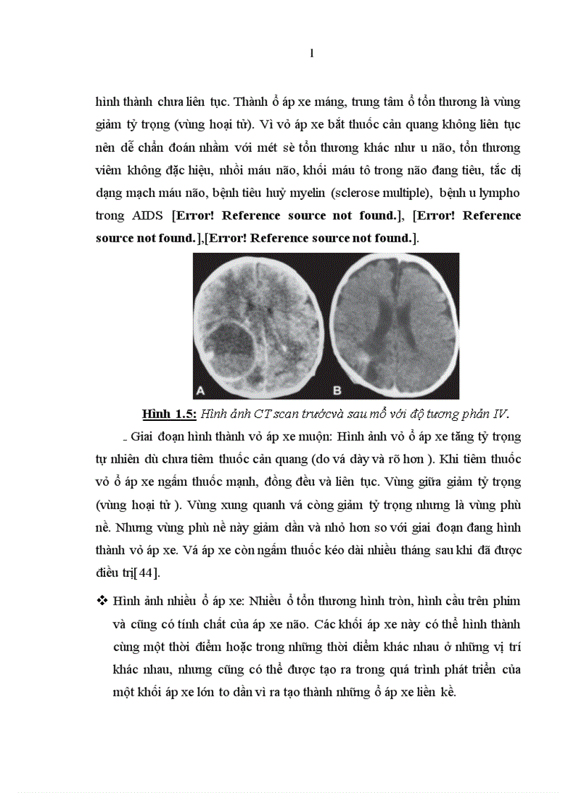 image for page Đặc điểm lâm sàng cận lâm sàng áp xe n o ở trẻ em