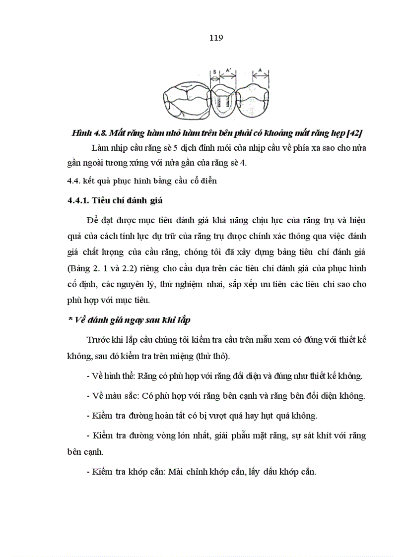 image for page Nghiên cứu răng trụ và đánh giá hiệu quả của cầu cổ điển