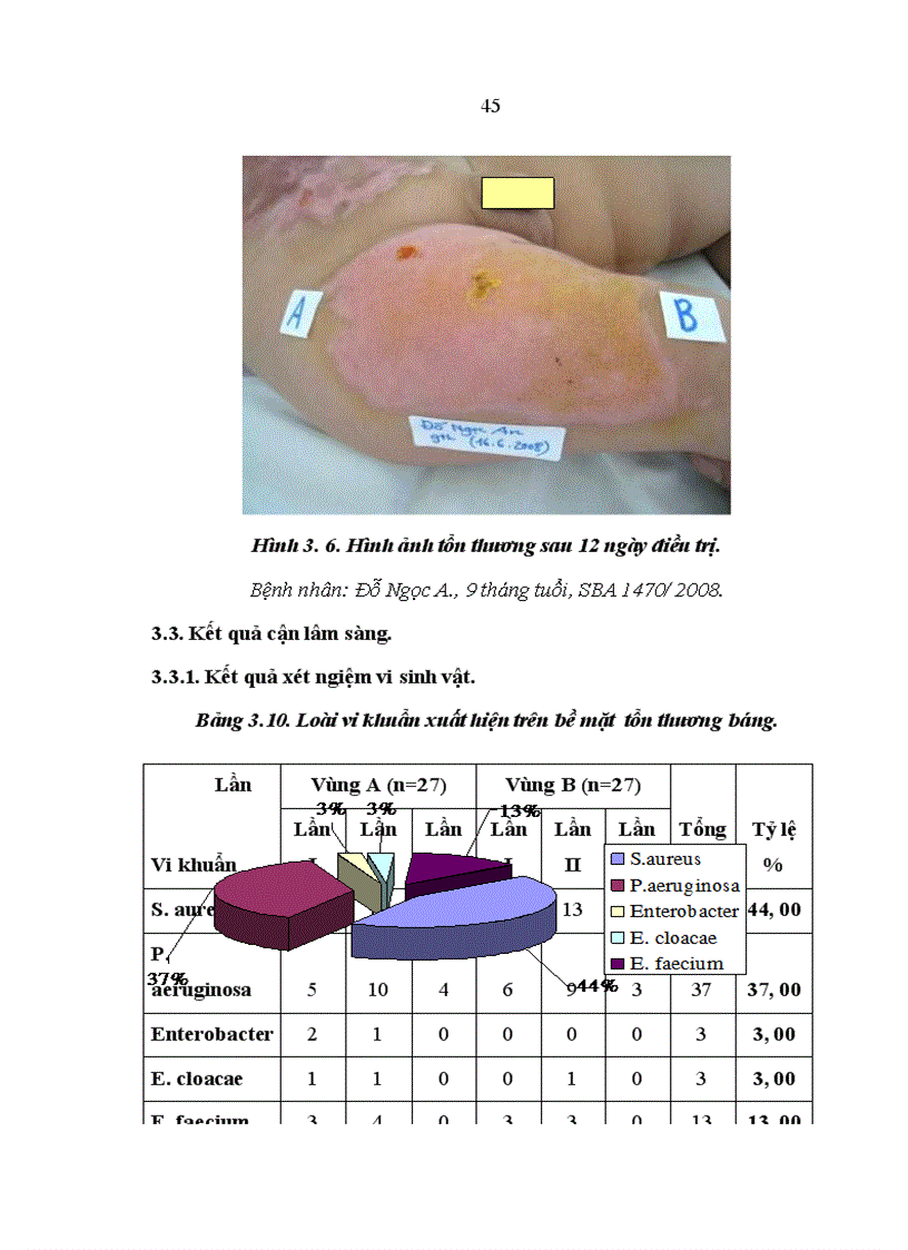 image for page Nghiên cứu hiệu quả kháng Pseudomonas aeruginosa và Staphylocous aureus của cao Lô hội trên thực nghiệm