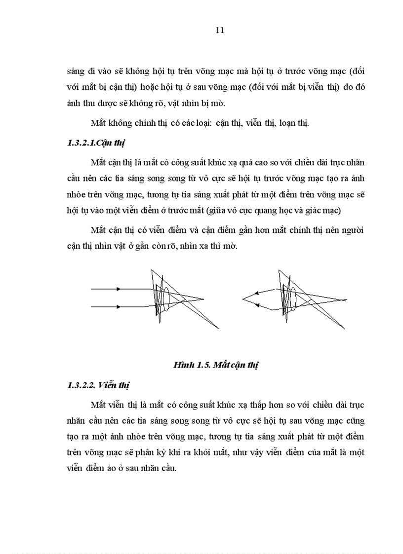 image for page Nghiên cứu sự thay đổi thị lực và khúc xạ sau phẫu thuật Lasik và một số yếu tố liên quan
