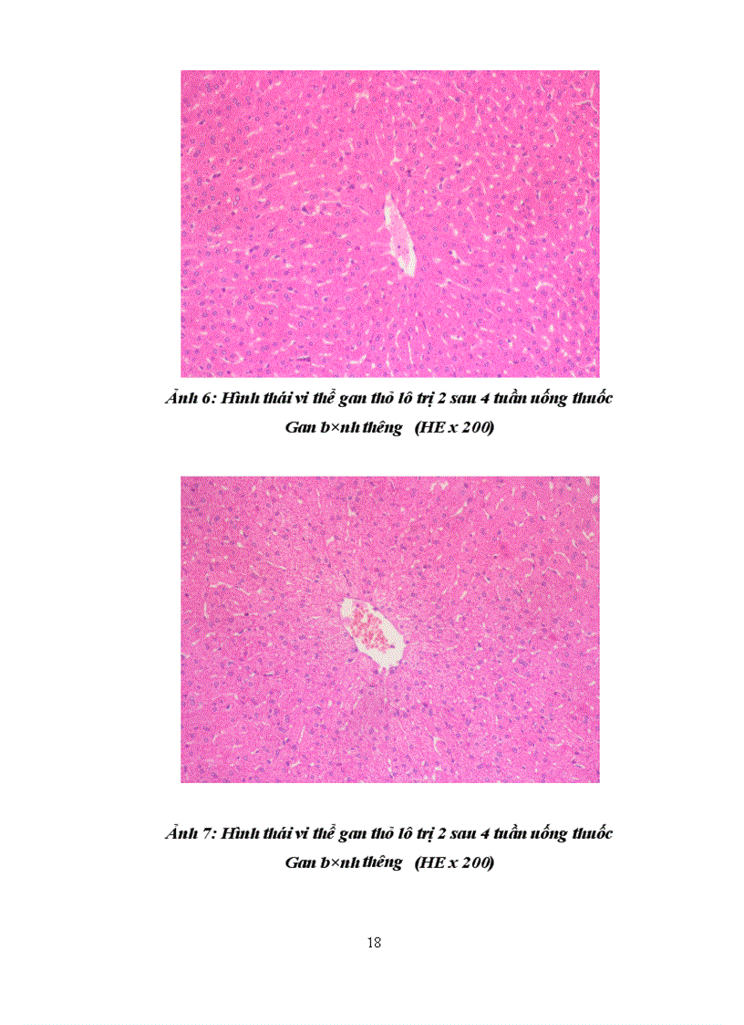 image for page Kết quả Nghiên cứu độc tính cấp và bán trường diễn của bài thuốc thân thống trục ứ thang trên thực nghiệm