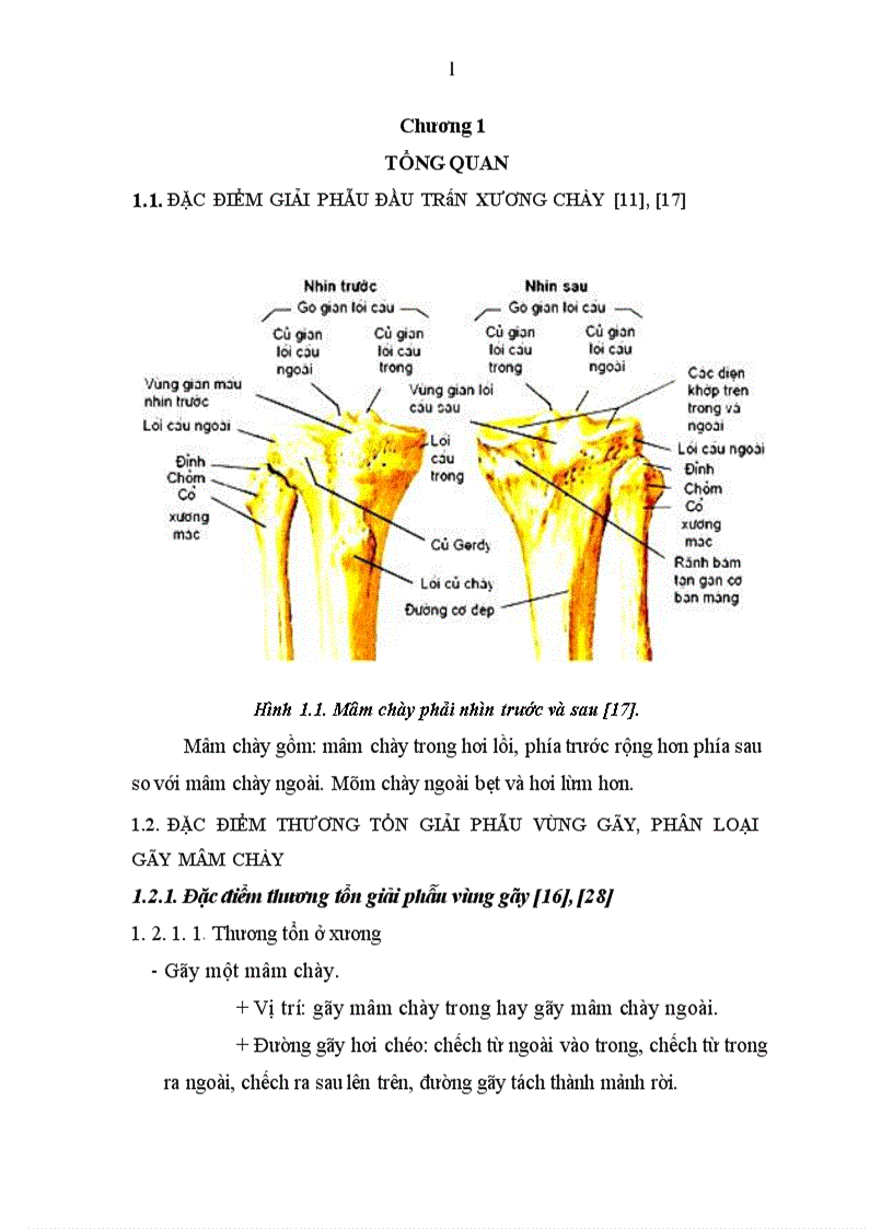 image for page Đánh giá các tổn thương và kết quả điều trị gãy mâm chày do chấn thương tại Bệnh viện 103 1