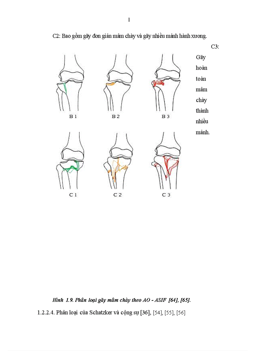 image for page Đánh giá các tổn thương và kết quả điều trị gãy mâm chày do chấn thương tại Bệnh viện 103 1