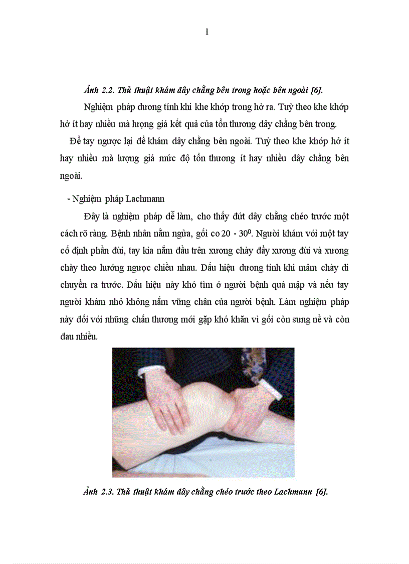 image for page Đánh giá các tổn thương và kết quả điều trị gãy mâm chày do chấn thương tại Bệnh viện 103 1