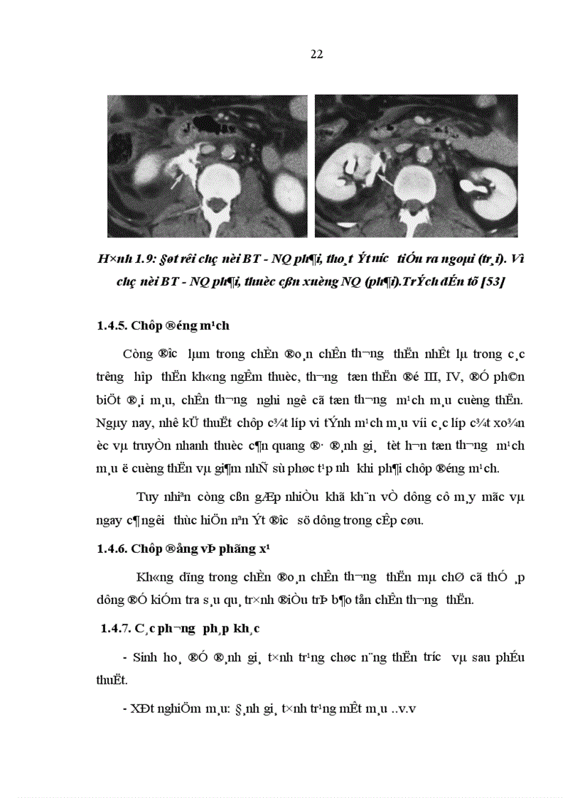 image for page Nghiên cứu đặc điểm lâm sàng cận lâm sàng và kết quả điều trị chấn thương thận không mổ tại bệnh viện Việt Đức