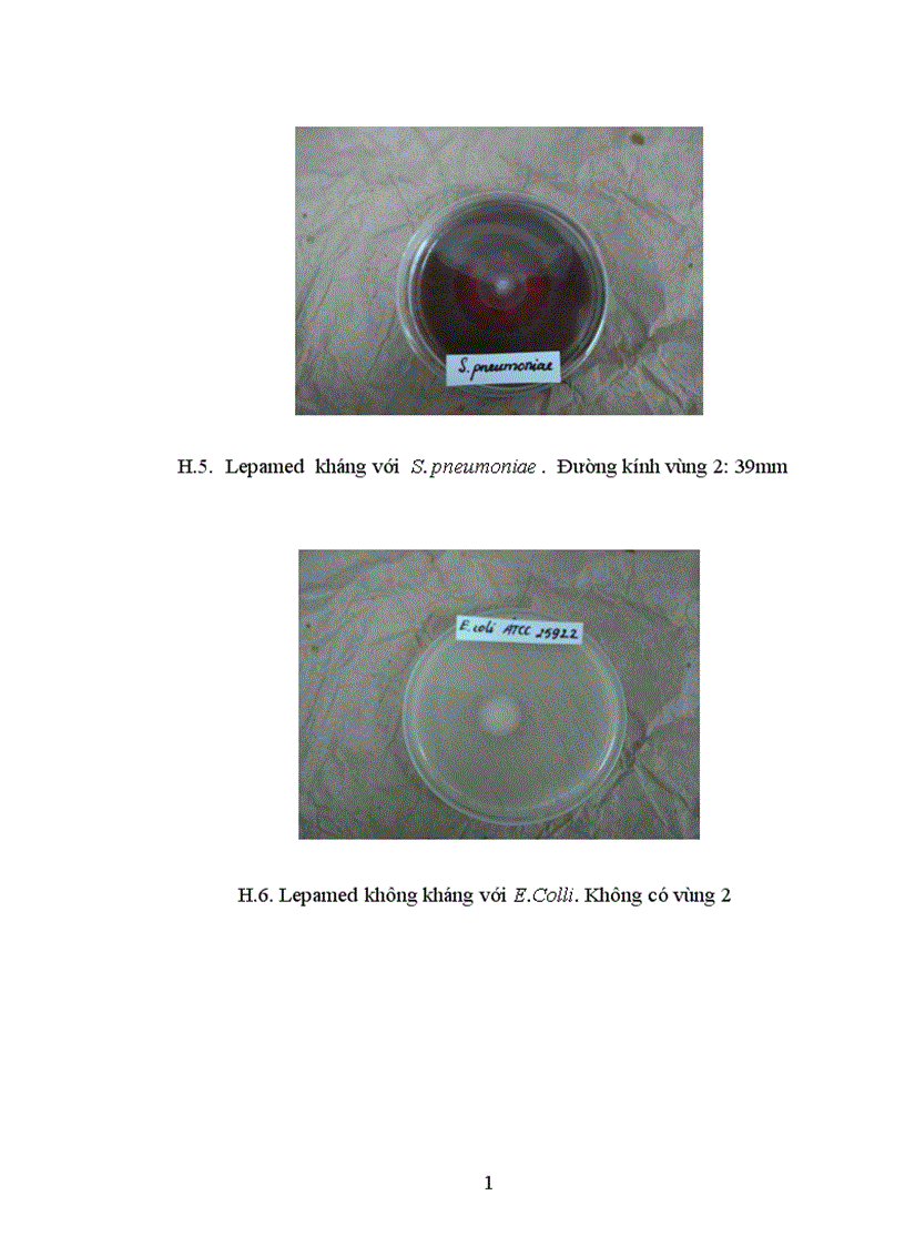 image for page Nghiên cứu tính phù hợp sinh học tính kháng khuẩn và khả năng liền mô của keo phẫu thuật Lepamed