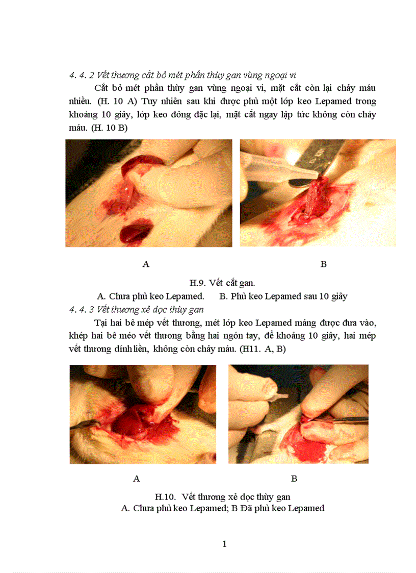 image for page Nghiên cứu tính phù hợp sinh học tính kháng khuẩn và khả năng liền mô của keo phẫu thuật Lepamed