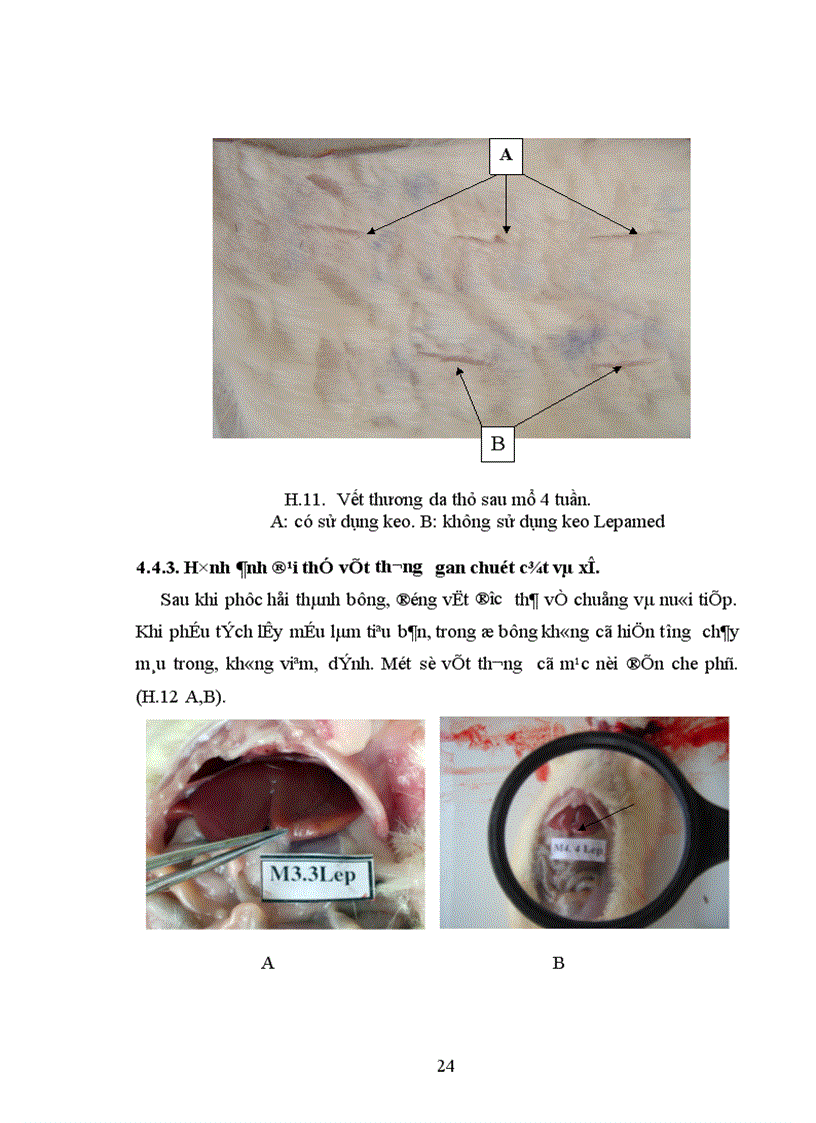 image for page Nghiên cứu tính phù hợp sinh học tính kháng khuẩn và khả năng liền mô của keo phẫu thuật Lepamed