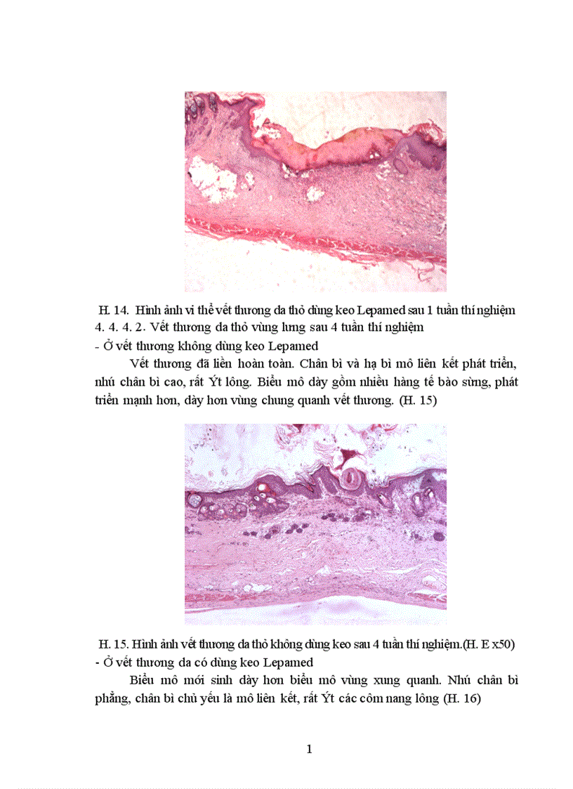 image for page Nghiên cứu tính phù hợp sinh học tính kháng khuẩn và khả năng liền mô của keo phẫu thuật Lepamed