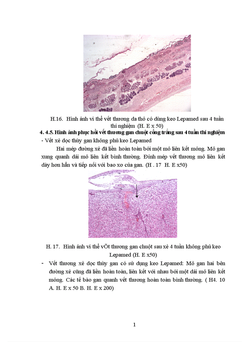 image for page Nghiên cứu tính phù hợp sinh học tính kháng khuẩn và khả năng liền mô của keo phẫu thuật Lepamed