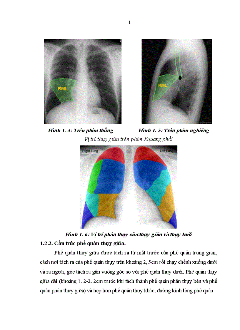 image for page Nghiên cứu đặc điểm lâm sàng cận lâm sàng nguyên nhân ở bệnh nhân có tổn thương phổi thùy giữa điều trị tại khoa Hô hấp Bệnh viện Bạch Mai 1