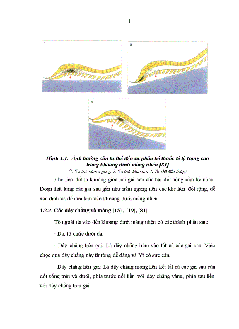 image for page So sánh tác dụng GTTS một bên với GTTS hai bên bằng bupivacain kết hợp fentanyl trong phẫu thuật chi dưới 1