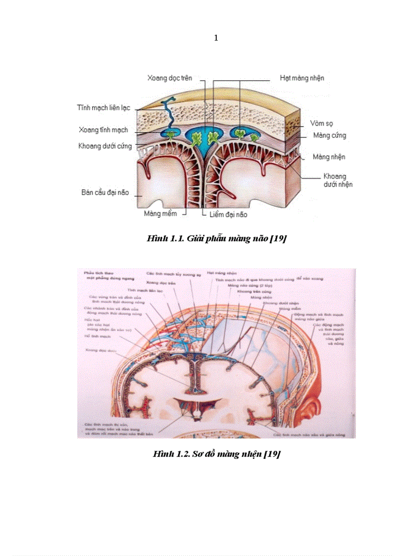 image for page Nghiên cứu đặc điểm lâm sàng hình ảnh học và một số biến chứng của bệnh nhân chảy máu dưới nhện do vỡ phình động mạch thông trước
