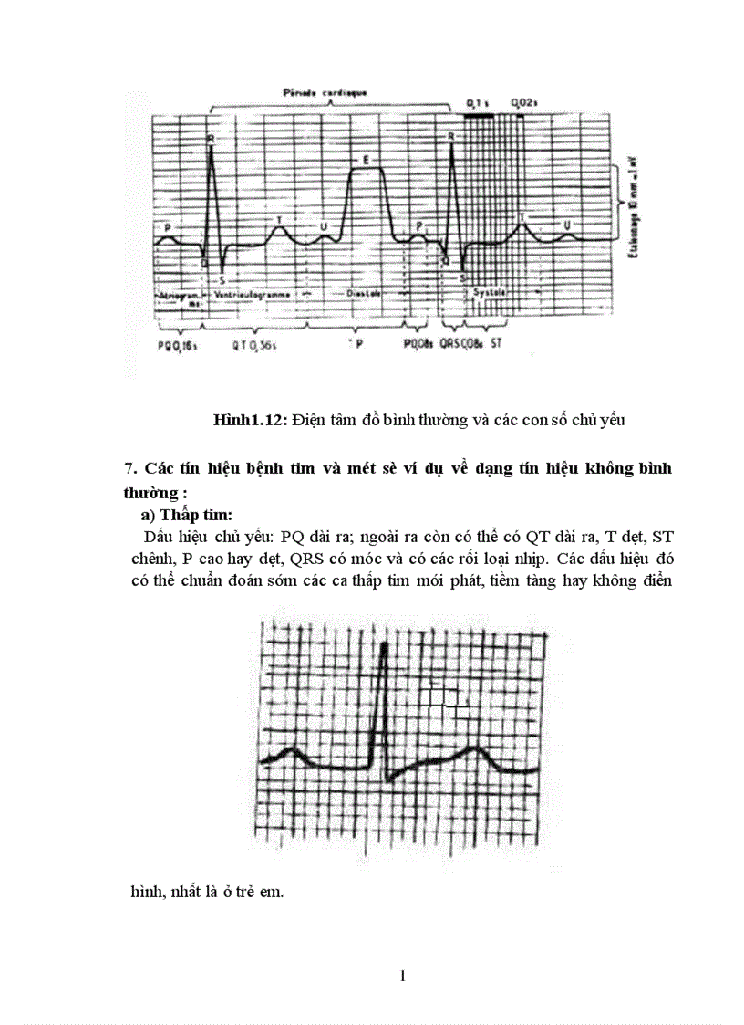 image for page Thiết kế máy điện tim 1