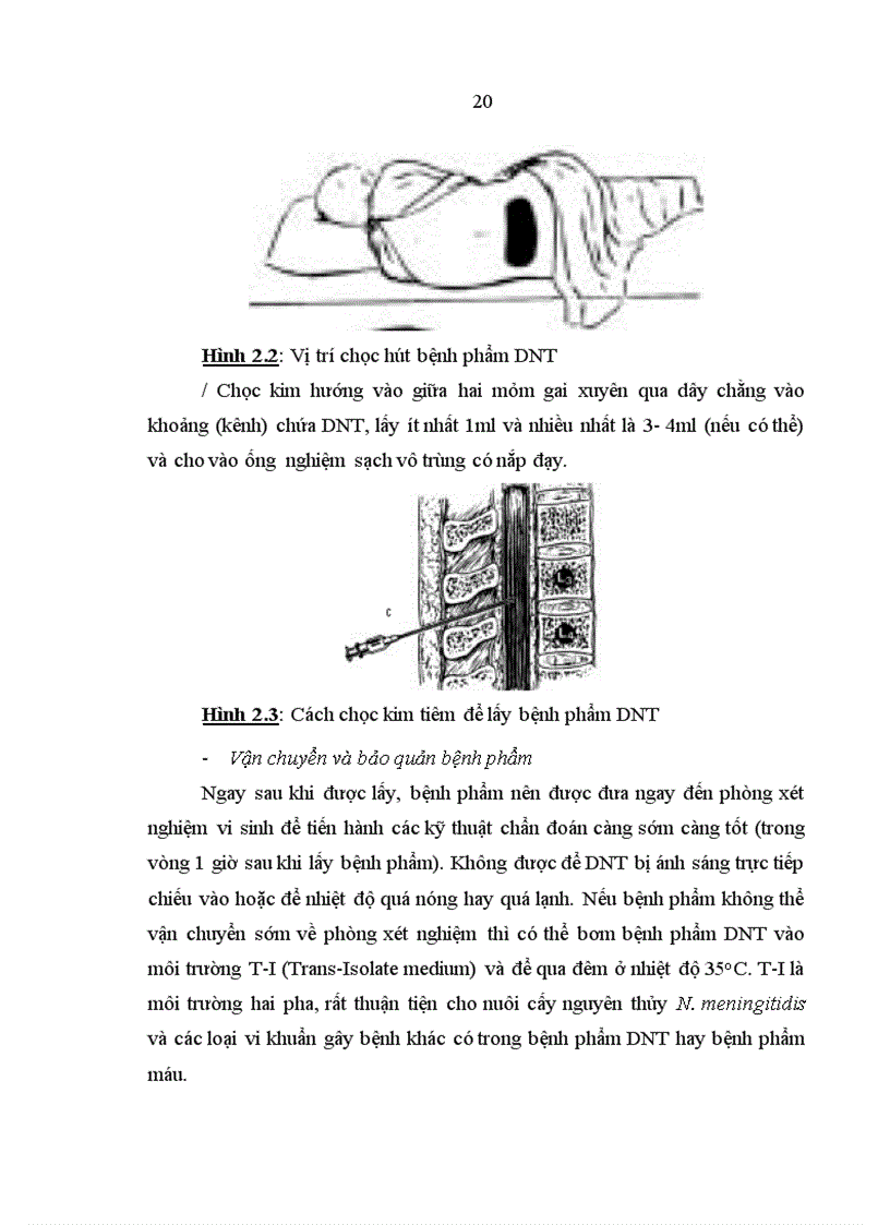 image for page Vai trò gây bệnh viêm màng não mủ cho trẻ dưới 5 tuổi của Haemophilus influenzae typ b và các phương pháp chẩn đoán phòng xét nghiệm