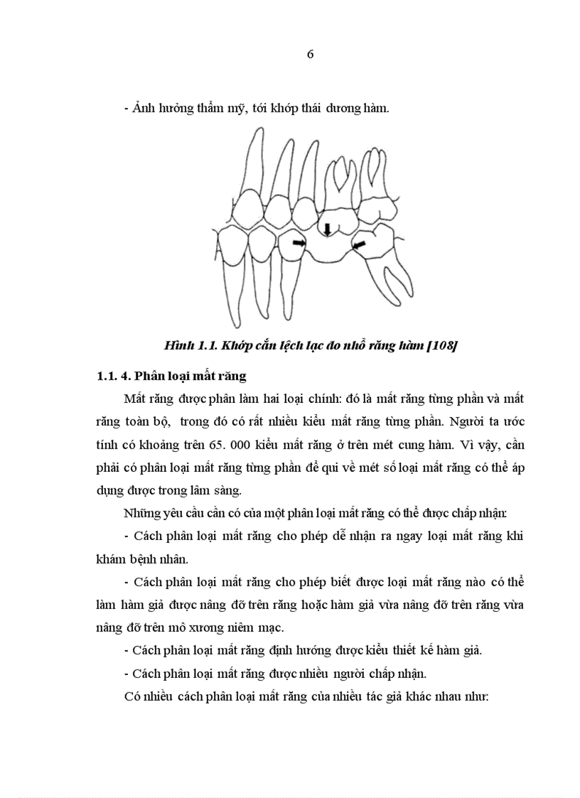 image for page Nghiên cứu răng trụ và đánh giá hiệu quả của cầu cổ điển