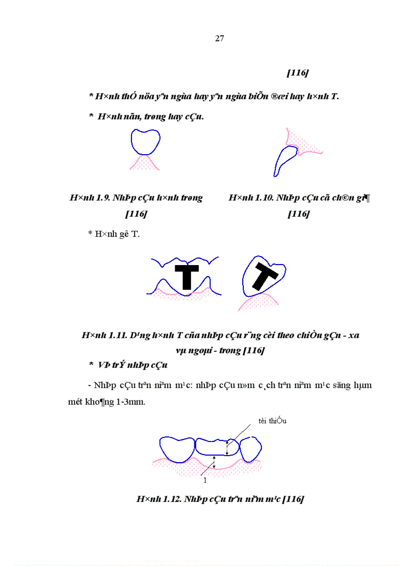 image for page Nghiên cứu răng trụ và đánh giá hiệu quả của cầu cổ điển
