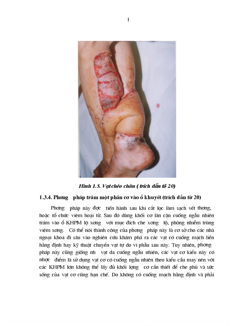 image for page Nghiên cứu kết quả điều trị khuyết hổng phần mềm 2 3 trên cẳng chân bằng vạt cơ BCT tại Bệnh viện Việt Đức