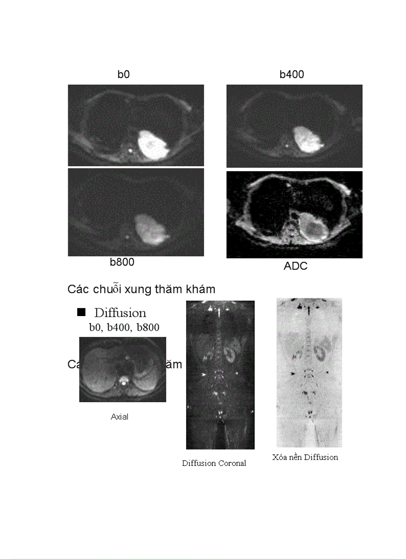 image for page Nguyên lý trọng khuyếch tán