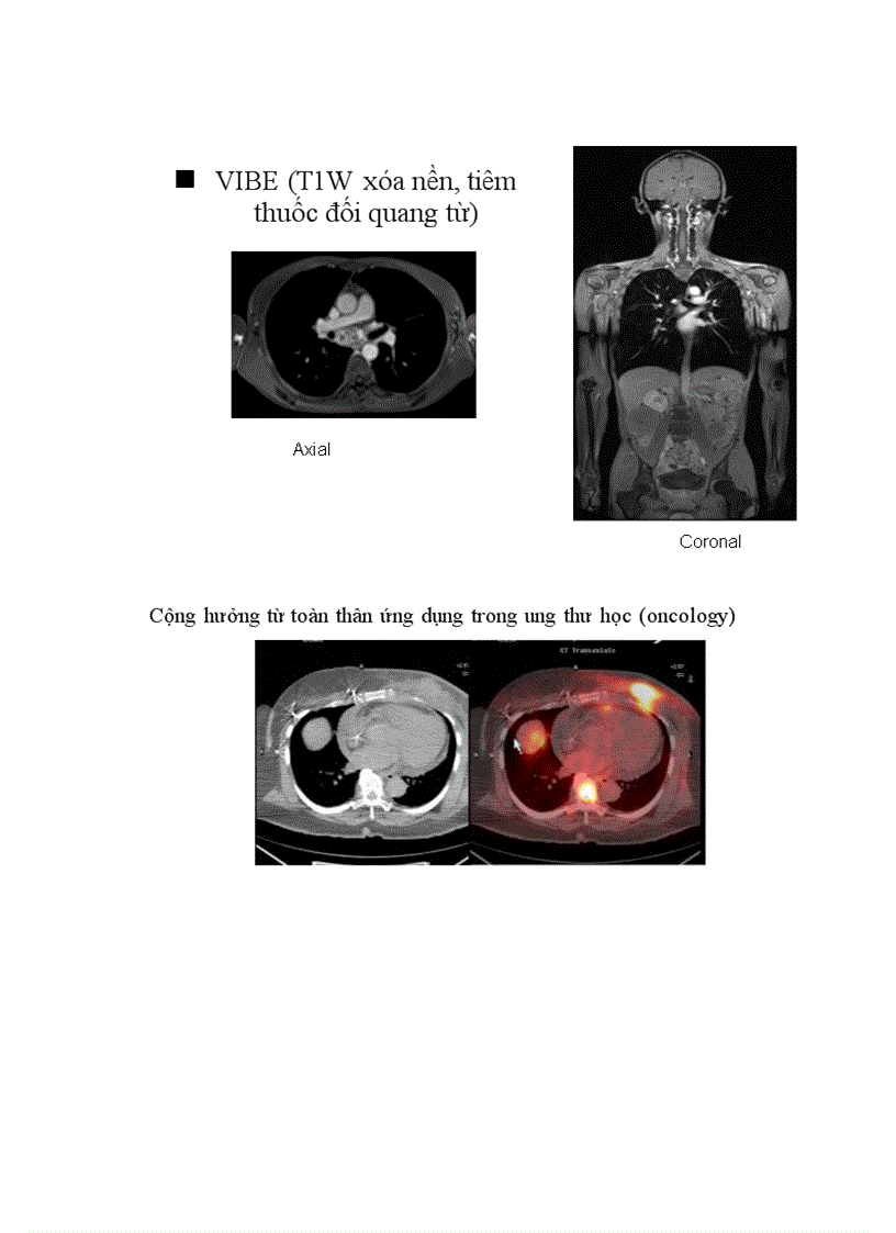 image for page Nguyên lý trọng khuyếch tán