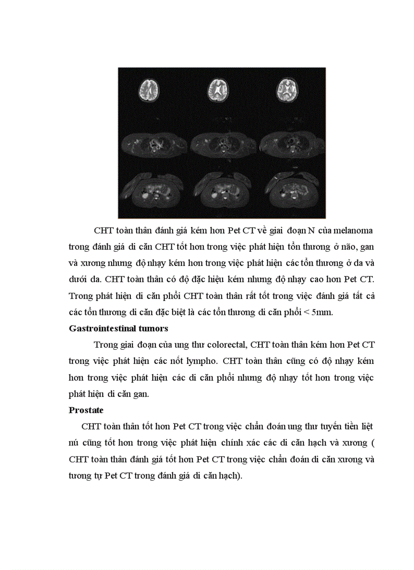 image for page Nguyên lý trọng khuyếch tán