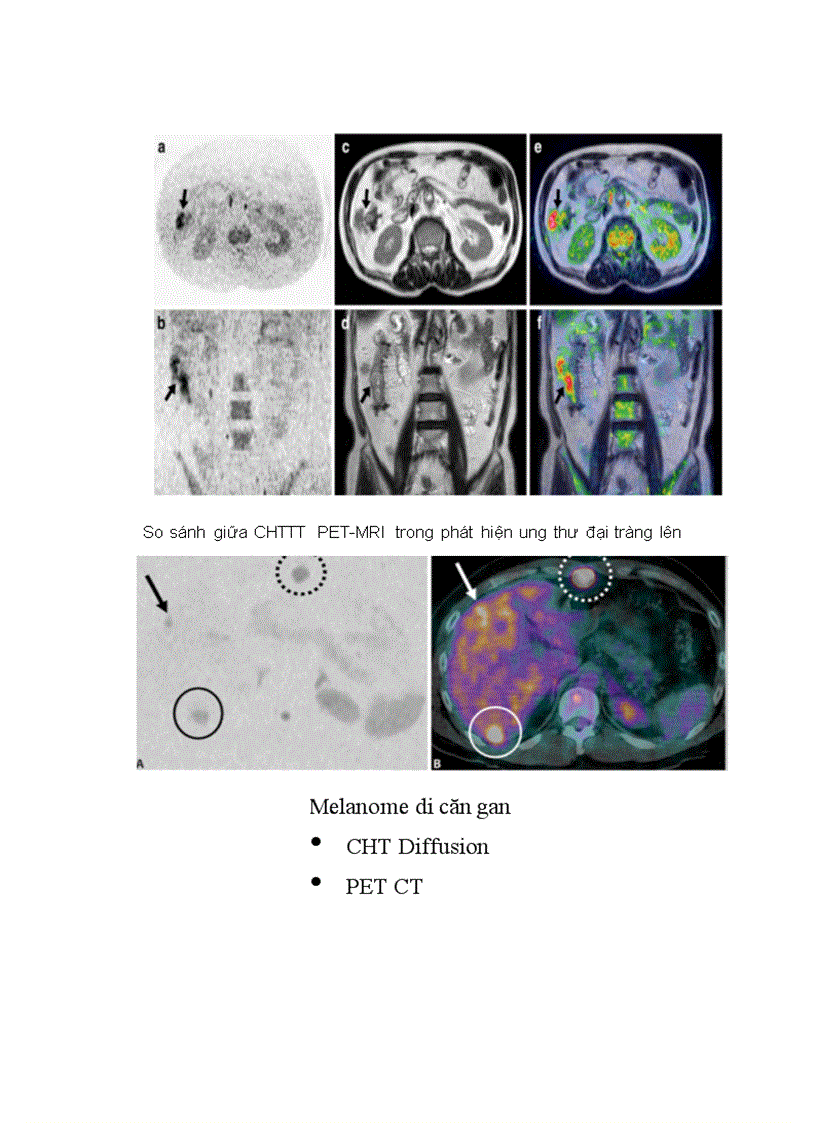 image for page Nguyên lý trọng khuyếch tán