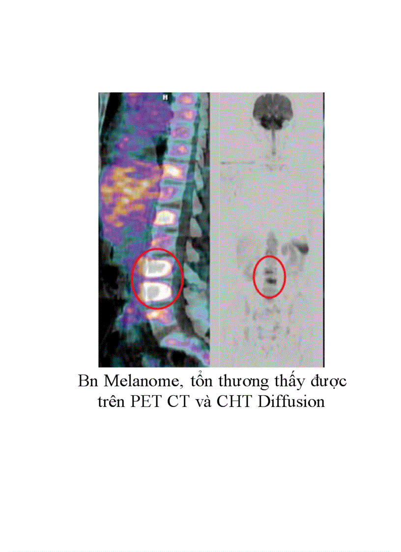 image for page Nguyên lý trọng khuyếch tán