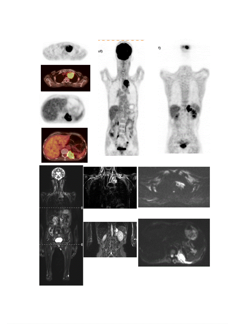 image for page Nguyên lý trọng khuyếch tán